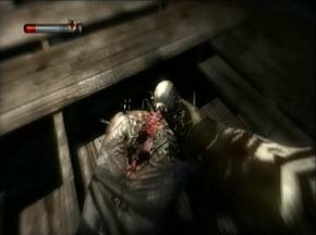 It's like playing Operation!